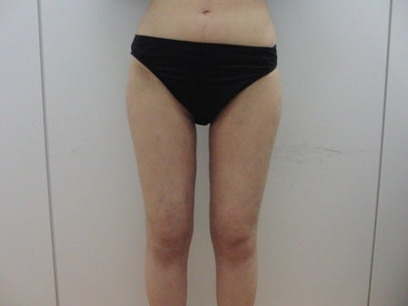 東京銀座 美容整形外科 美容皮膚科 レティシアクリニック