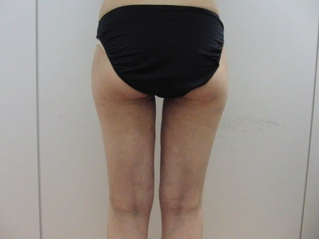 東京銀座 美容整形外科 美容皮膚科 レティシアクリニック