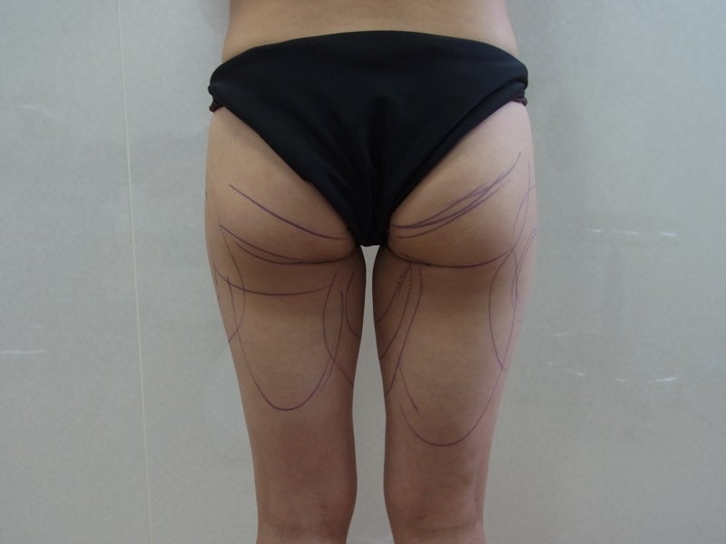 東京銀座　美容整形外科　美容皮膚科　レティシアクリニック