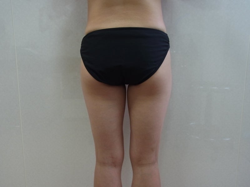 東京銀座　美容整形外科　美容皮膚科　レティシアクリニック