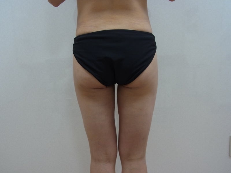 東京銀座　美容整形外科　美容皮膚科　レティシアクリニック