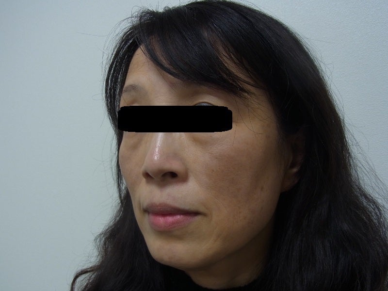 東京銀座　美容整形外科　美容皮膚科　レティシアクリニック