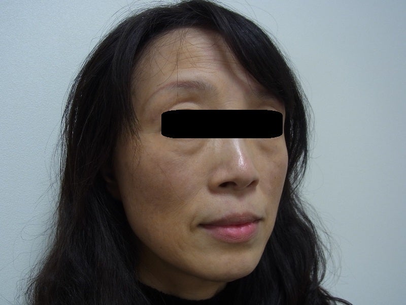 東京銀座　美容整形外科　美容皮膚科　レティシアクリニック