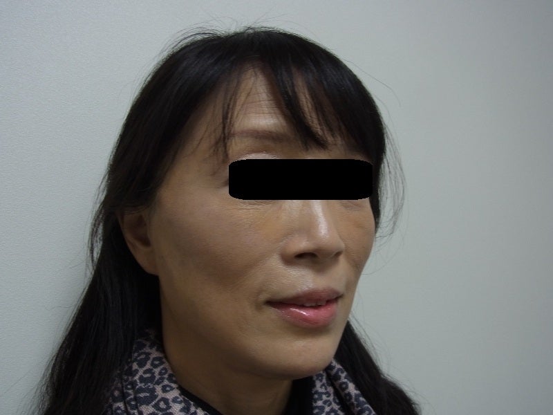 東京銀座　美容整形外科　美容皮膚科　レティシアクリニック