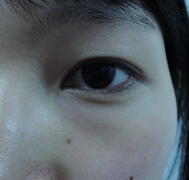 東京銀座 美容整形外科 美容皮膚科 レティシアクリニック