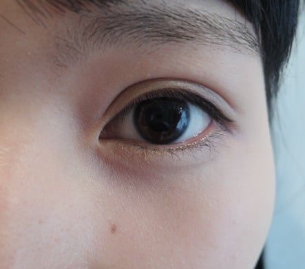 東京銀座 美容整形外科 美容皮膚科 レティシアクリニック