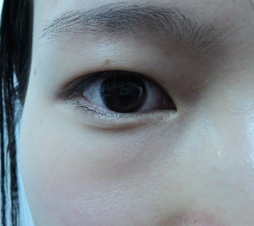 東京銀座 美容整形外科 美容皮膚科 レティシアクリニック