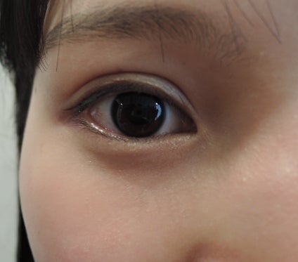 東京銀座 美容整形外科 美容皮膚科 レティシアクリニック