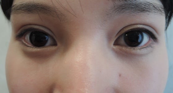 東京銀座 美容整形外科 美容皮膚科 レティシアクリニック