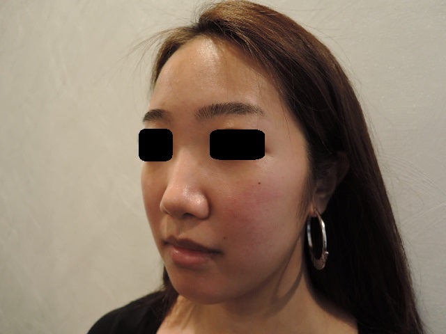 東京銀座　美容整形外科　美容皮膚科　レティシアクリニック