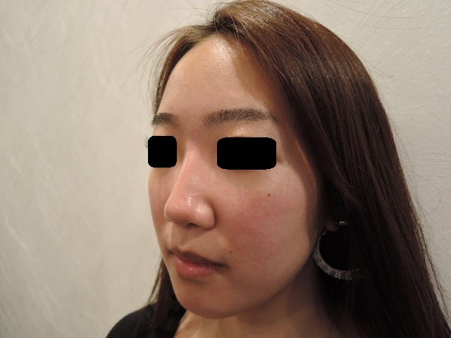 東京銀座　美容整形外科　美容皮膚科　レティシアクリニック