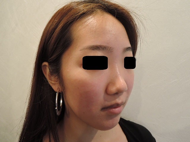 東京銀座　美容整形外科　美容皮膚科　レティシアクリニック