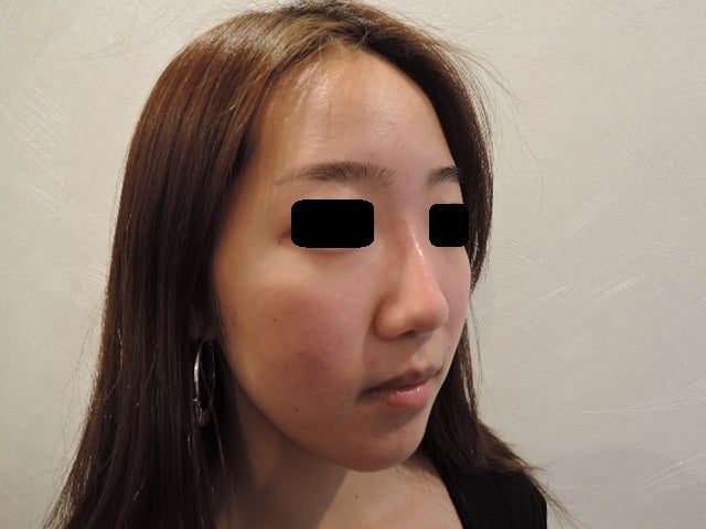 東京銀座　美容整形外科　美容皮膚科　レティシアクリニック