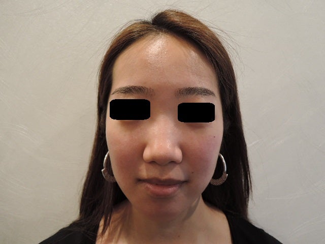 東京銀座　美容整形外科　美容皮膚科　レティシアクリニック