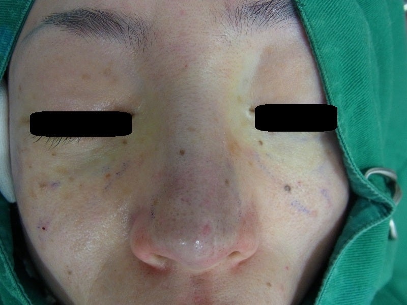 東京銀座 美容整形外科 美容皮膚科 レティシアクリニック