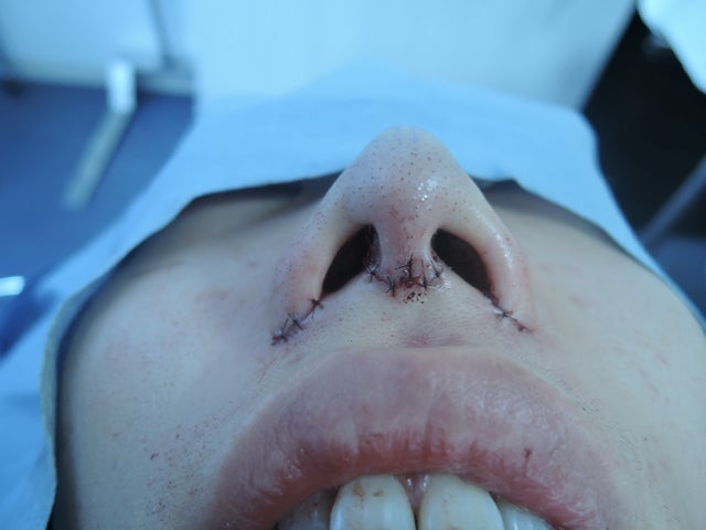 東京銀座　美容整形外科　美容皮膚科　レティシアクリニック