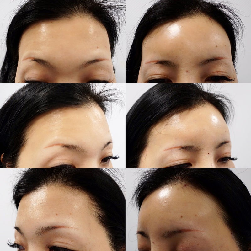 東京銀座　美容整形外科　美容皮膚科　レティシアクリニック