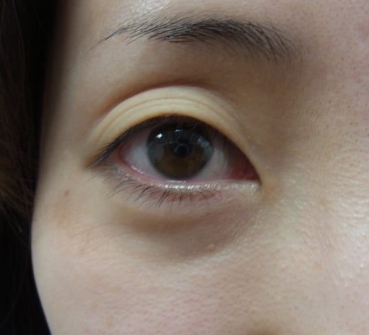 東京銀座　美容整形外科　美容皮膚科　レティシアクリニック