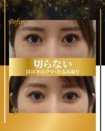 ワイコフェイスフルイド（WiQo)-Red - レティシアクリニック Leticia